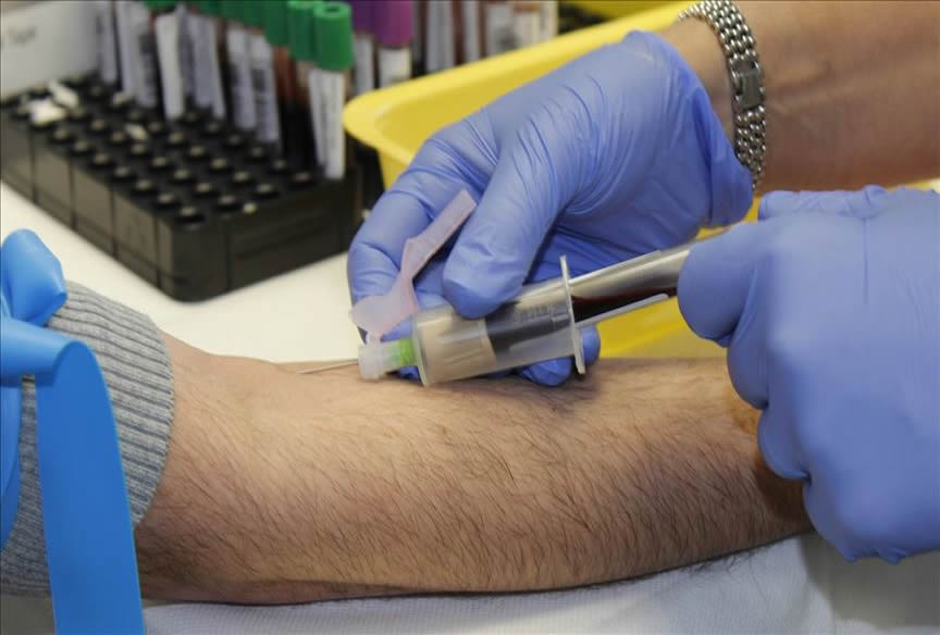 Covid-19 salgını döneminde kalp damar hastaları ne yapmalı