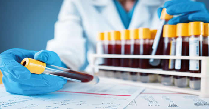 Plazma Tedavisi Fosmu Çıktı? Prof. Dr. Osman Müftüoğlunun Kitabım Hakkındaki Köşe Yazısı